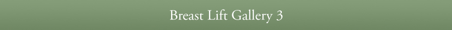 Breast Lift Gallery 3