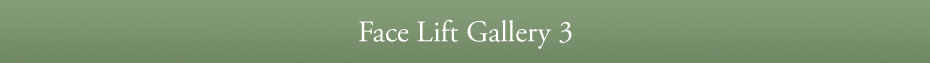 Face Lift Gallery 3