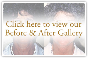 Click here to view our Before & After Gallery