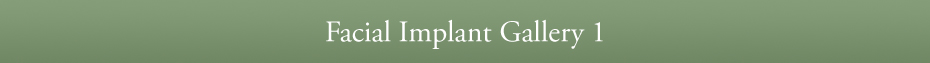 Facial Implants Gallery 1