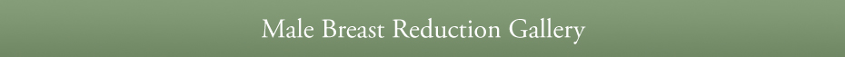 Male Breast Reduction Gallery